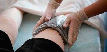 Отложение солей в голеностопном суставе лечение народными средствами thumbnail